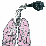 devon kerslake_SCIENCE_lung cancer_colour